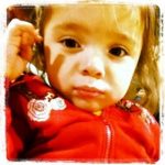 Monique's Story (Bi-Coronal Craniosynostosis). LR