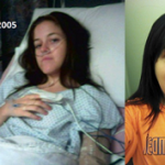 Jessica's Story (Colitis) LR