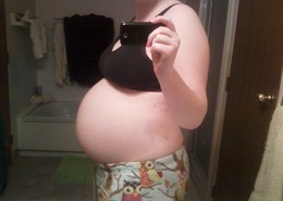 Stephanie's Story (Endometriosis)