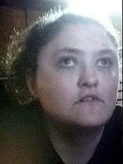 Laura's Story (Lupus)