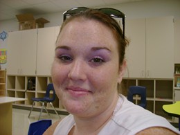 Tiffani's Story (Synovial Sarcoma) LR