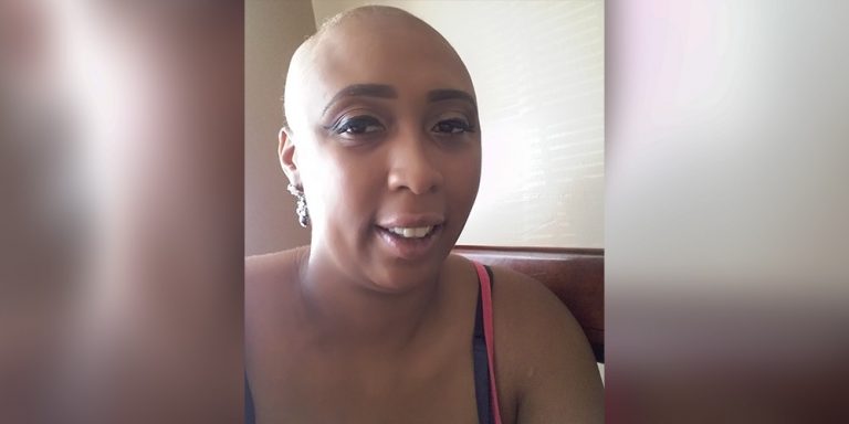 Jasmine Breast Cancer