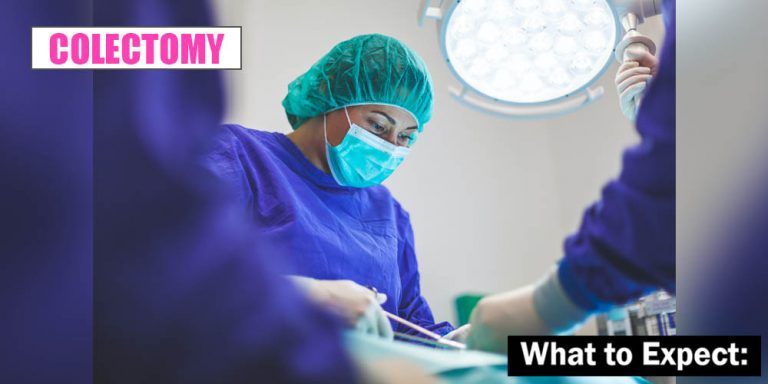 What to Expect - Colectomy