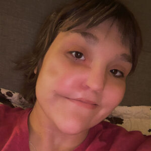 aimees story angiasarcoma