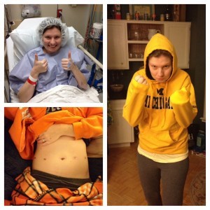 Kristen's Story (Endo)