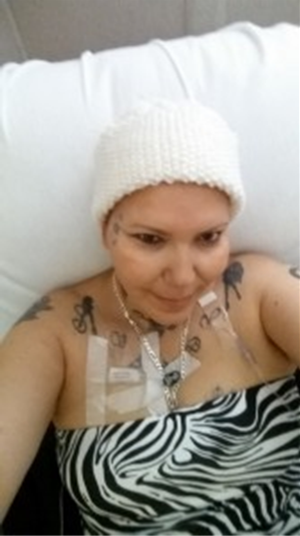 Faye's Story (Breast Cancer)