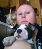 Tammy's Story Lupus Fibromyalgia