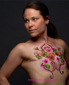 Jamie's Story Breast Cancer