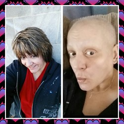 Sli's Story Ovarian Cancer