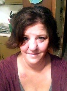 Michelle's Story Gallbladder Cancer