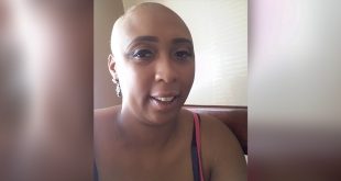 Jasmine Breast Cancer