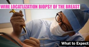wire localization biopsy featured image
